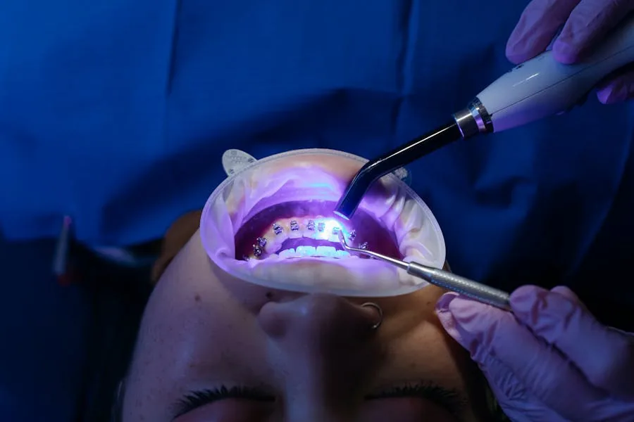 Patient receiving a professional teeth whitening treatment